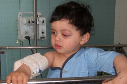 Adam, un niño marroquí de 14 meses, padece cáncer de ojos.