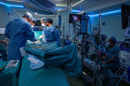 El jefe de cirugía cardiovascular del Clínic, Manuel Castellà y su equipo preparan a la paciente para extraer el corazón dañado antes de que llegue el órgano donado.