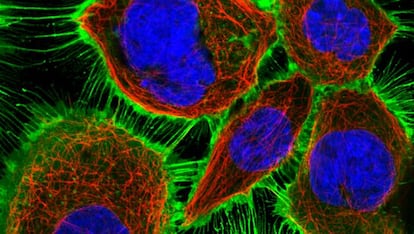 El receptor del factor de crecimiento epidérmico (EGFR), en verde; el esqueleto celular, en rojo, y el material genético del núcleo, en azul.