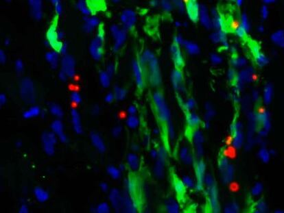 Im&aacute;gen de c&eacute;lulas madre cardiacas humanas empleadas en la fase de experimentaci&oacute;n previa en ratones.  