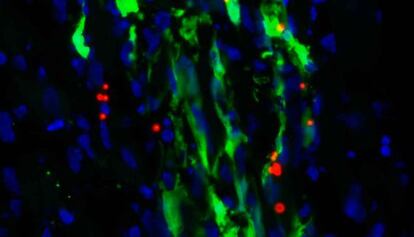 Im&aacute;gen de c&eacute;lulas madre cardiacas humanas empleadas en la fase de experimentaci&oacute;n previa en ratones.  