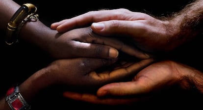 Las manos de una mujer africana a quien se le realizó una reconstrucción del clítoris en la clínica Dexeus de Barcelona en 2010 y su médico.