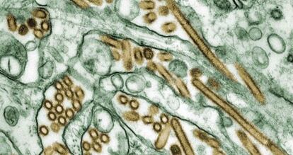 Micrografía del virus de la gripe aviar N5H1 (en color dorado) en un cultivo de células (en verde).