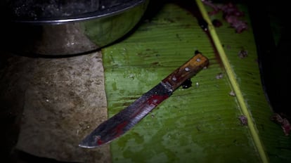 Machete utilizado para despellejar al puercoespín, un ejemplo de las condiciones en las que se manipulan estos alimentos.