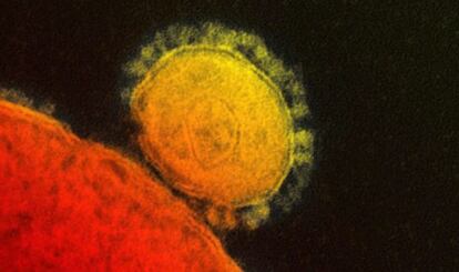 Imagem do coronavírus (amarelo) do Instituto Nacional para Alergia e as Enfermidades Infecciosas.