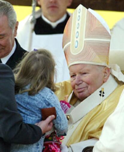 El Papa sostiene a una niña siamesa que fue separada de su hermana.