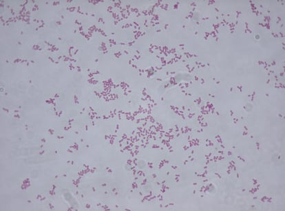 Fotografa microscpica de la bacteria Klebsiella oxytoca.