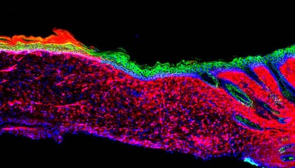 Piel de un ratón regenerada 'in vivo' por primera vez.