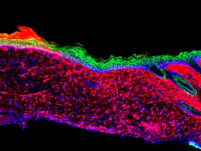 Piel de un ratón regenerada 'in vivo' por primera vez.