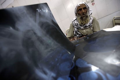 Un paciente que padece tuberculosis recibe tratamiento en un hospital local en Peshawar, Pakistán. La tuberculosis es una de las enfermedades que ha generado en muchos casos resistencia a los antibióticos.