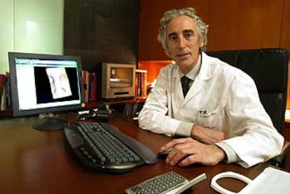 Javier Herrero, en el centro médico Teknon de Barcelona.
