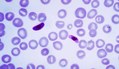 Muestra de sangre que contiene varias formas del par&aacute;sito de la malaria, &#039;Plasmodium falciparum&#039;