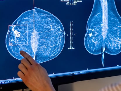 Personal sanitario analiza una mamografía en un hospital de Berlín, en Alemania.