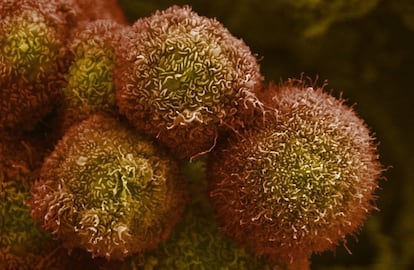 Células de cáncer de páncreas cultivadas en el laboratorio.