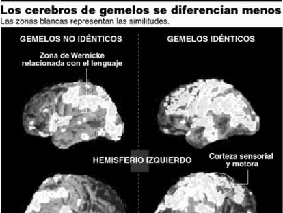 Cerebro de gemerlos