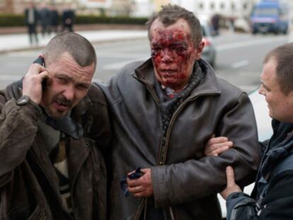 Un herido es atendido fuera de la estación de Minsk donde se ha registrado una fuerte explosión.