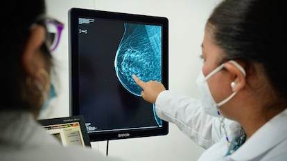 Personal médico analiza una mastografía en Ciudad de México, en octubre pasado.