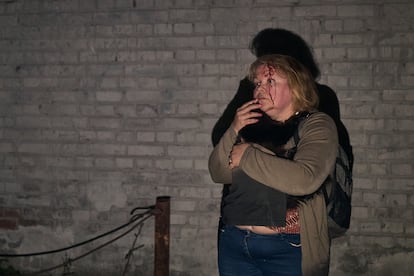 Una mujer herida, tras el ataque ruso sobre Kiev, este jueves.