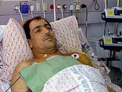 Igal Cohel, ciudadano judío al que le fue trasplantado el corazón de un palestino muerto por bala, el lunes en Tel Aviv.
