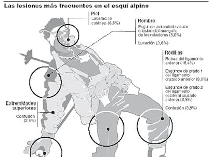 Las lesiones más frecuentes de los esquiadores