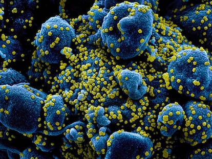 Una imagen del virus SARS-CoV-2 en microscopio.