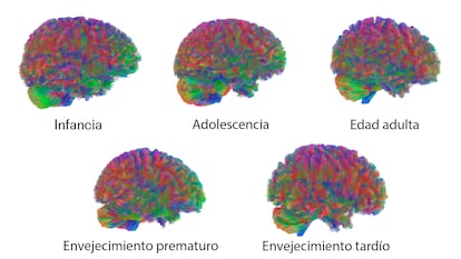 Edades del cerebro humano