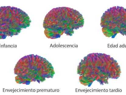 Edades del cerebro humano