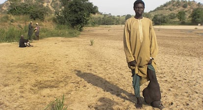 Un nigeriano afectado de filariasis linfática muestra su pierna, con los síntomas irreversibles de la elefantiasis.