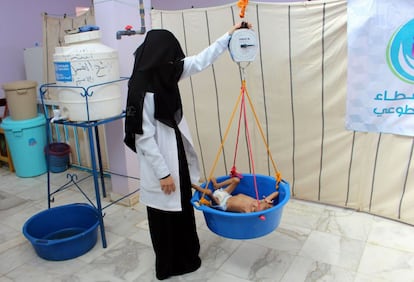 Un niño yemení que sufre de desnutrición severa es pesado en un centro de tratamiento en un hospital en la provincia de Hajjah, en el noroeste de Yemen. Alrededor de 14 millones de personas están al borde de una hambruna, según denunciaron el miércoles 35 ONG locales e internacionales, que pidieron un "cese inmediato de hostilidades".