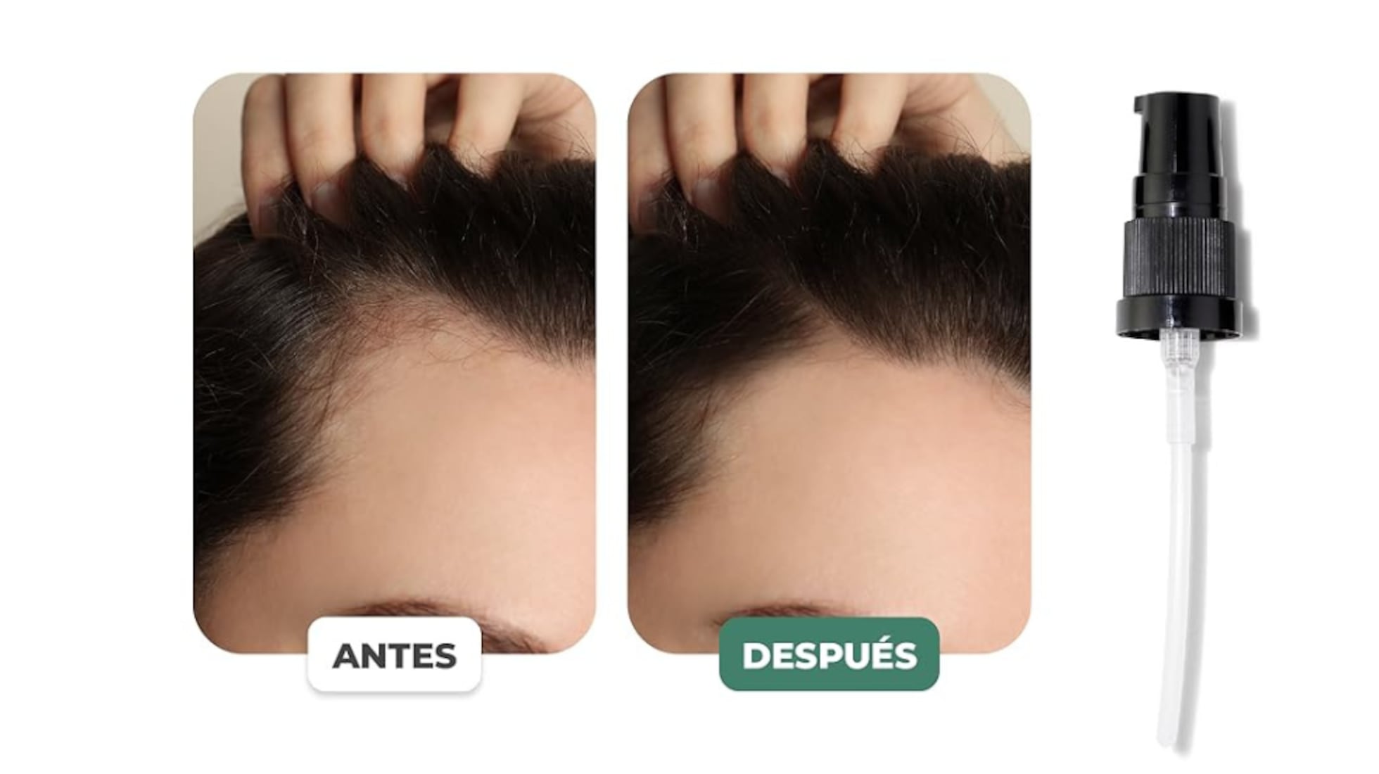 Los 5 beneficios de usar aceite de ricino 100% puro y natural en tu cabello  | Belleza | Escaparate | EL PAÍS