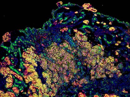 Imagen del organoide creado por el IBEC