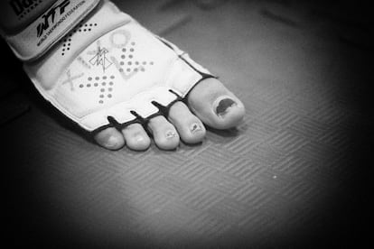 Los pies son unas de las zonas que más se machacan en el taekwondo.