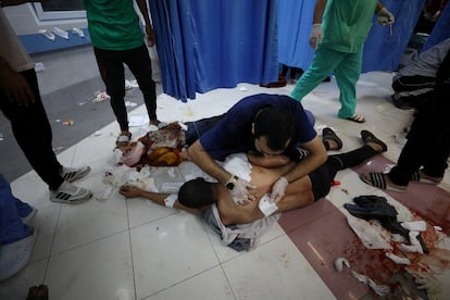 Un sanitario atendía a un herido del bombardeo al hospital Al Ahli, en el centro sanitario Al Shifa.
