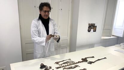 Parte de los restos óseos del cadáver de la niña hallado en el Alcázar en abril de 2021, presentados el jueves en Sevilla.