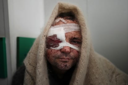 Serhiy Kralya, de 41 años, herido tras un bombardeo tras ser ingresado en un hospital de Mariupol. El presidente francés, Emmanuel Macron, y el canciller alemán, Olaf Scholz, aseguraron que el mandatario de Rusia, Vladímir Putin, no tiene intención de "parar la guerra" y alertaron que planean aplicar al régimen ruso sanciones al nivel que las decididas contra Irán.