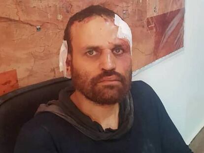 El yihadista egipcio Hisham Ashmawy tras ser detenido este lunes en Derna (Libia).
