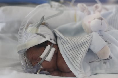 Mohamid nació a las 26 semanas de gestación,12 antes de lo previsto. Está ingresado en la Unidad de Cuidados Intensivos para neonatos.