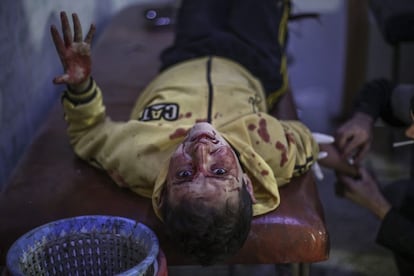 Un niño herido recibe atención médica en un hospital tras un ataque áereo de las fuerzas leales al gobierno sirio en la localidad de Douma, a las afueras de Damasco (Siria).