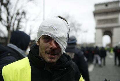 Los primeros enfrentamientos entre agentes antidisturbios y manifestantes han comenzado con el lanzamiento de piedras y de gases lacrimógenos en torno al Arco del Triunfo, en París, poco después de las dos y media de la tarde hora local y peninsular española.