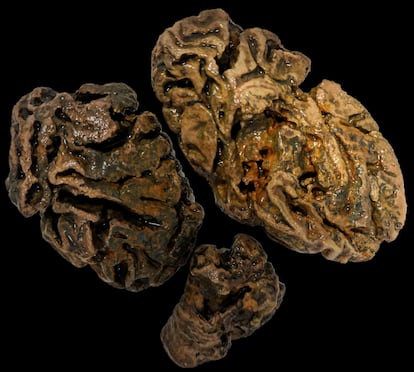 Fragmentos del cerebro de un individuo enterrado en Bristol (Reino Unido) hace más de 200 años. Ningún otro tejido blando se ha conservado.