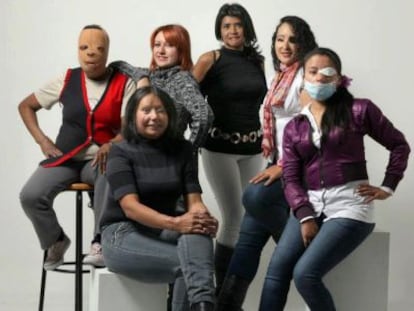 Mujeres víctimas de ataques con ácido en Colombia