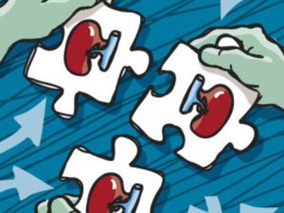 Cadena de trasplantes