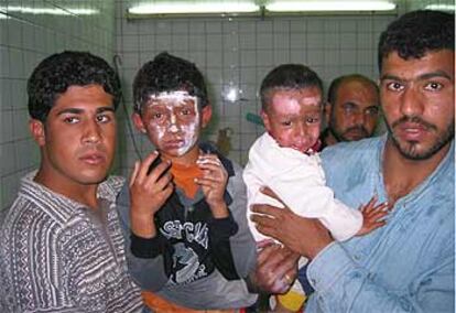 Una familia muestra a dos niños con la cara quemada por la explosión de una bomba en Bagdad.
