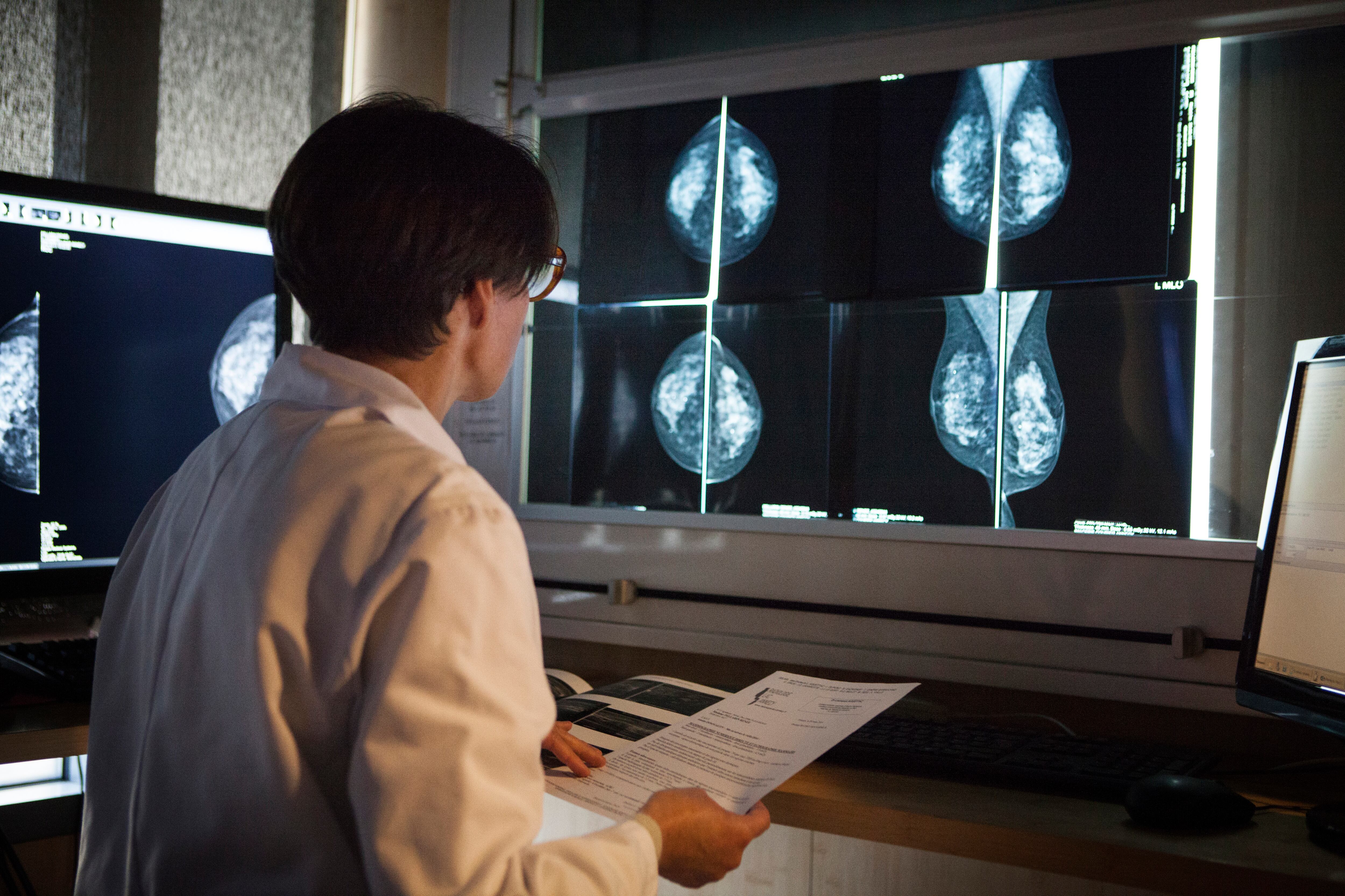 Una radióloga supervisa los resultados de una mamografía.