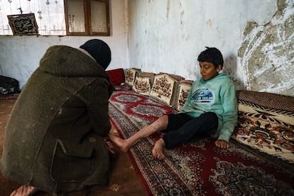 Abdul Rahman al Safar's mother puts creams on her son's wound, which still needs special care.