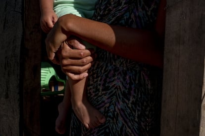 Los niños que corretean por las veredas sin nada parecido al asfalto solo conocen la pobreza. A diferencia de sus padres, ellos no saben lo que es la comodidad. Los hijos de la frontera crecen sin agua potable, sin luz y con menús intermitentes. La necesidad la sufren desde antes de nacer.