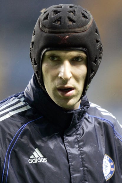 El portero del Chelsea Peter Cech juega con casco desde hace tres años.