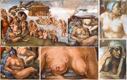 This image shows the alleged breast cancer depicted in 'The Flood." In Image 1F, there is an older woman with healthy breasts represented in the upper right corner of 'The Final Judgment' in the Sistine Chapel. 