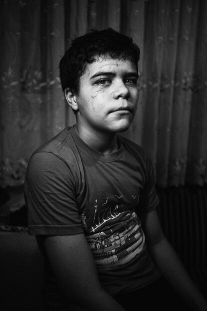 Hesham, de 13 años, estaba con su padre en un puesto de venta de frutas en Alepo cuando las fuerzas gubernamentales sirias bombardearon la zona. La metralla le dejó heridas en la cara y los hombros. Tenía solo 12 años. Su familia se fue a Estambul y, casi un año después de llegar a Turquía, Hesham trabaja en turnos de 10 horas en una fábrica textil produciendo zapatillas falsificadas.