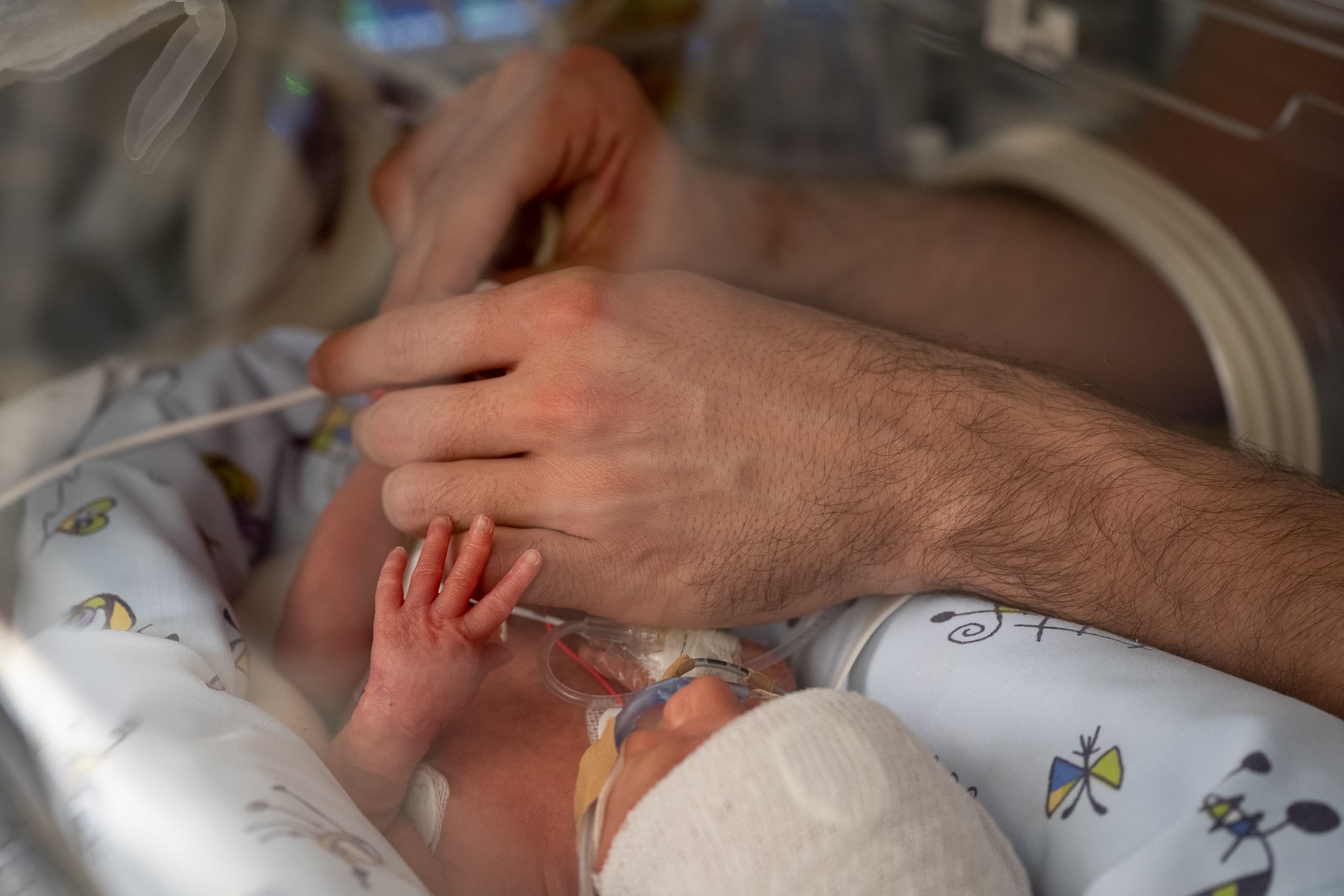 La donación de sangre de cordón umbilical se abre camino para tratar la anemia en bebés muy prematuros